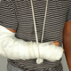 Illustration for article titled A broken arm changes your brain